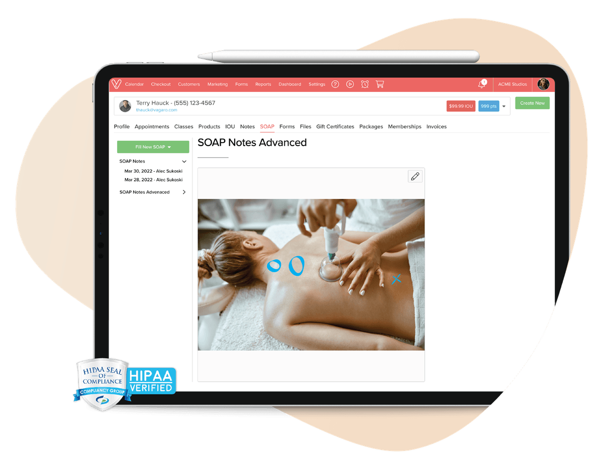 SOAP notes with image of person receiving cupping therapy. HIPAA-verified seal in the bottom-left corner of the image.
